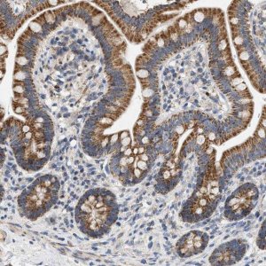 Anti-MCU antibody produced in rabbit 