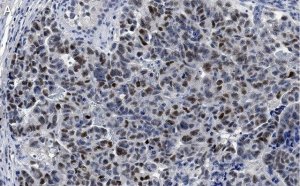 Anti-MDM2 Antibody, clone IF2 ZooMAb Mouse Monoclonal 