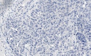 Anti-MDM2 Antibody, clone IF2 ZooMAb Mouse Monoclonal 