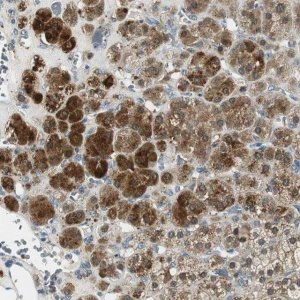 Anti-ME1 antibody produced in rabbit HPA006493-100UL