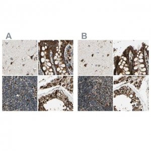 Anti-ME2 antibody produced in rabbit 