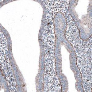 Anti-ME3 antibody produced in rabbit 