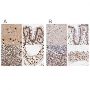 Anti-MED12 antibody produced in rabbit 
