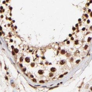 Anti-MED12 antibody produced in rabbit 