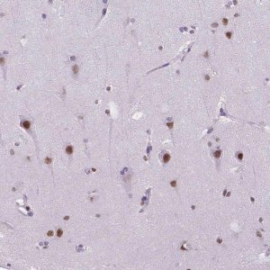 Anti-MEF2C antibody produced in rabbit 