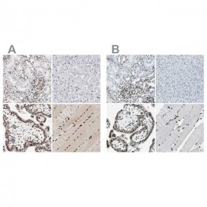 Anti-MEF2D antibody produced in rabbit 