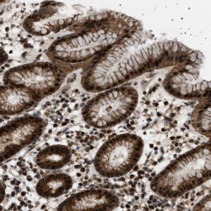 Anti-MELK antibody produced in rabbit 