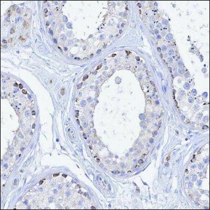 Anti-MERTK antibody produced in rabbit HPA036196-100UL
