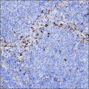 Anti-MERTK antibody produced in rabbit HPA036196-100UL