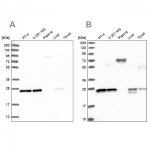 Anti-MESDC2 antibody produced in rabbit 