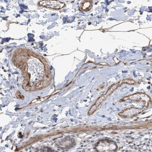 Anti-METAP1D antibody produced in rabbit 