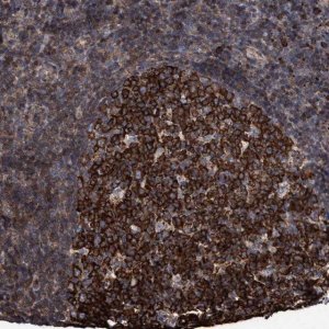 Anti-METAP2 antibody produced in rabbit 