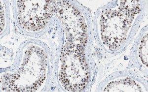 Anti-METTL14 Antibody, clone 2G22 ZooMAb Rabbit Monoclonal 