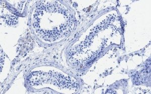 Anti-METTL14 Antibody, clone 2G22 ZooMAb Rabbit Monoclonal 