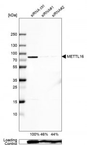 Anti-METTL16 antibody produced in rabbit 