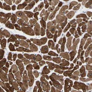 Anti-METTL16 antibody produced in rabbit 