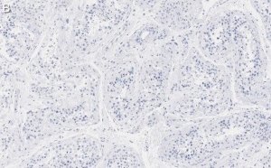 Anti-METTL7A Antibody, clone 1O8 ZooMAb Rabbit Monoclonal 