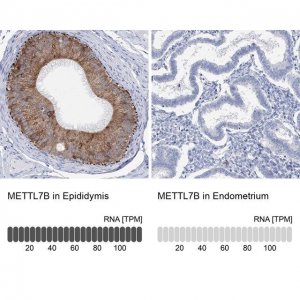 Anti-METTL7B antibody produced in rabbit 