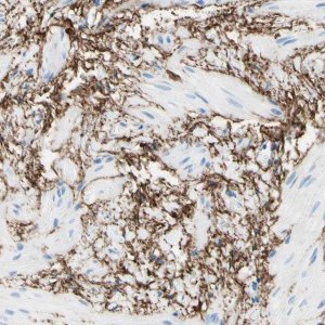 Anti-MFAP5 antibody produced in rabbit 