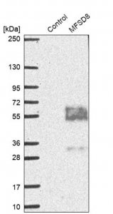Anti-MFSD8 antibody produced in rabbit 
