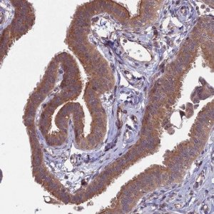 Anti-MFSD8 antibody produced in rabbit 