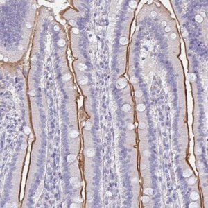 Anti-MGAM2 antibody produced in rabbit 