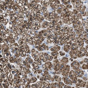 Anti-MGARP antibody produced in rabbit 