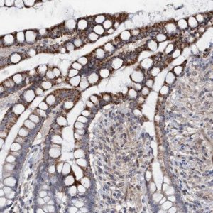 Anti-MGLL antibody produced in rabbit 
