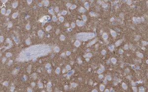 Anti-mGluR5 Antibody, clone 1F11 ZooMAb Rabbit Monoclonal 