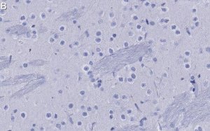 Anti-mGluR5 Antibody, clone 1F11 ZooMAb Rabbit Monoclonal 