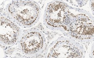 Anti-MGMT Antibody, clone 2N19 ZooMAb Rabbit Monoclonal 