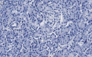 Anti-MICA Antibody, clone 4F8 ZooMAb Rabbit Monoclonal 