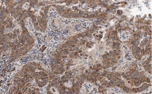 Anti-MICB Antibody, clone 2K9 ZooMAb Rabbit Monoclonal 