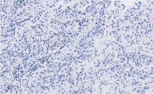Anti-MICB Antibody, clone 2K9 ZooMAb Rabbit Monoclonal 