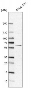 Anti-MICU3 antibody produced in rabbit 