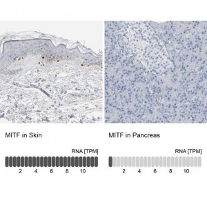 Anti-MITF antibody produced in rabbit 
