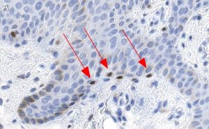 Anti-MITF Antibody, clone 1E2 ZooMAb Rabbit Monoclonal 