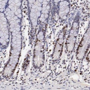 Anti-MKI67 antibody produced in rabbit 