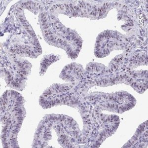 Anti-MKI67IP antibody produced in rabbit 