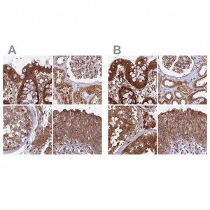 Anti-MKKS antibody produced in rabbit HPA041071-100UL