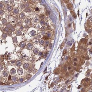 Anti-MKKS antibody produced in rabbit HPA041071-100UL