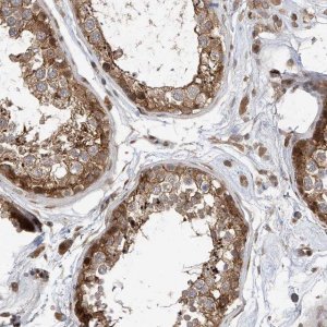 Anti-MKL1 antibody produced in rabbit 