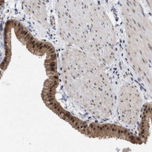 Anti-MKNK2 antibody produced in rabbit 