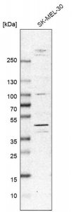 Anti-MKNK2 antibody produced in rabbit 