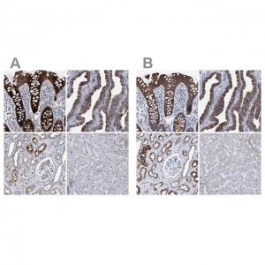 Anti-MKS1 antibody produced in rabbit 