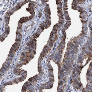 Anti-MKS1 antibody produced in rabbit 