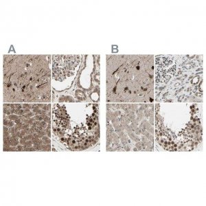 Anti-MLF2 antibody produced in rabbit 