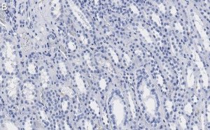 Anti-MLL/HRX CT Antibody, clone 5C15 ZooMAb Rabbit Monoclonal 