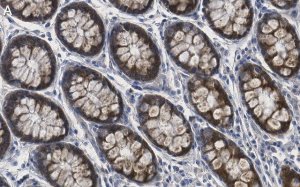Anti-MMP-14 Antibody, clone 1J5 ZooMAb Rabbit Monoclonal 