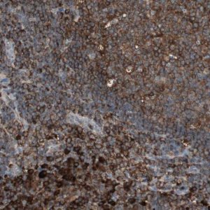 Anti-MMP3 antibody produced in rabbit 